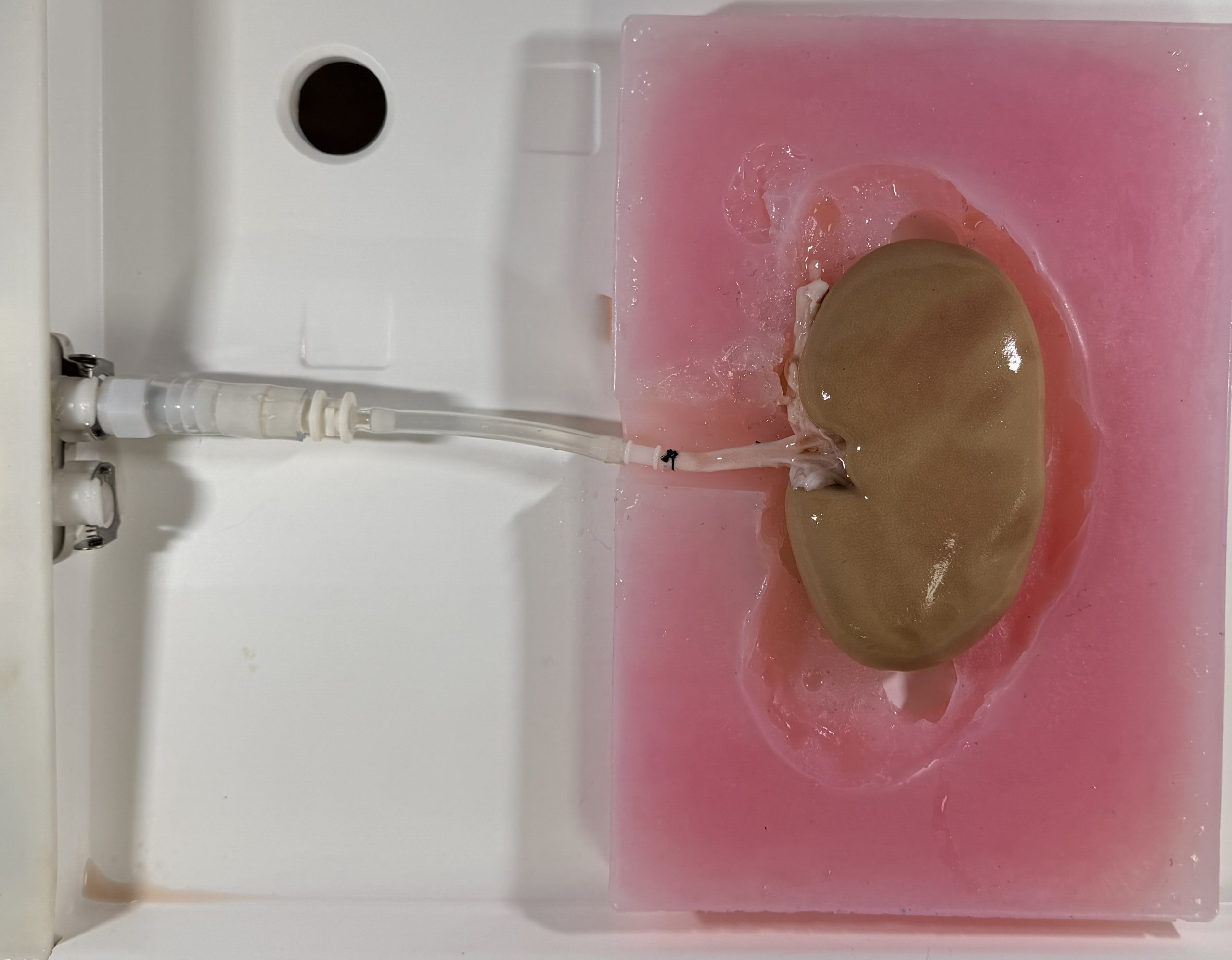 Kidney Model