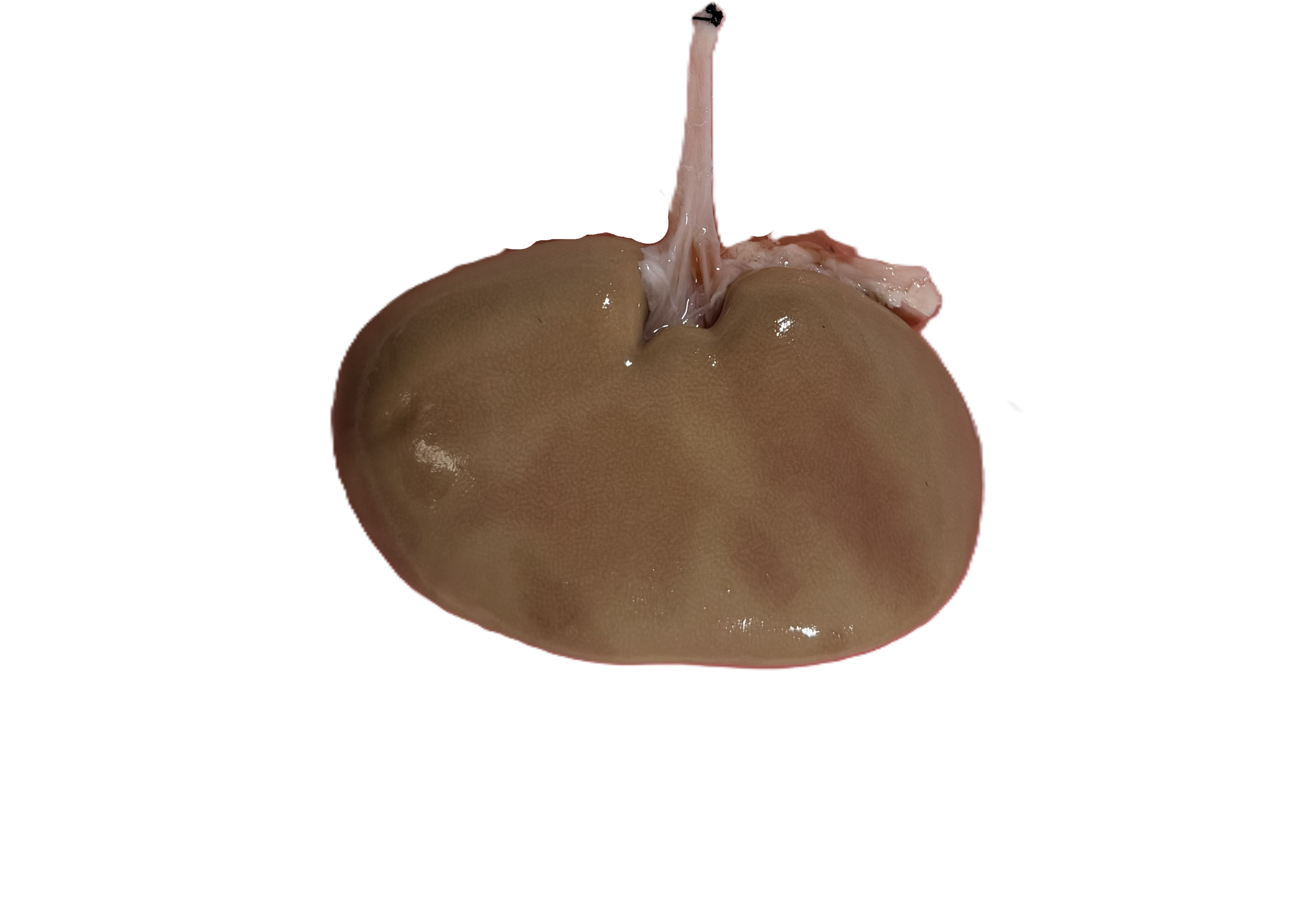 Kidney Model